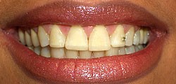 esteticadentale esteticadentale